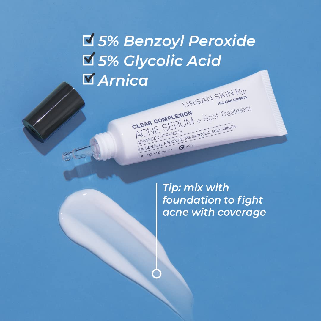 Urban Skin Rx Clear Complexion Acne Serum + Spot Treatment | Helps to Reduce + Prevent Breakouts, Improves the Look of Blemishes and Aging Skin with 5% Benzoyl Peroxide and 5% Glycolic Acid | 1 Fl Oz