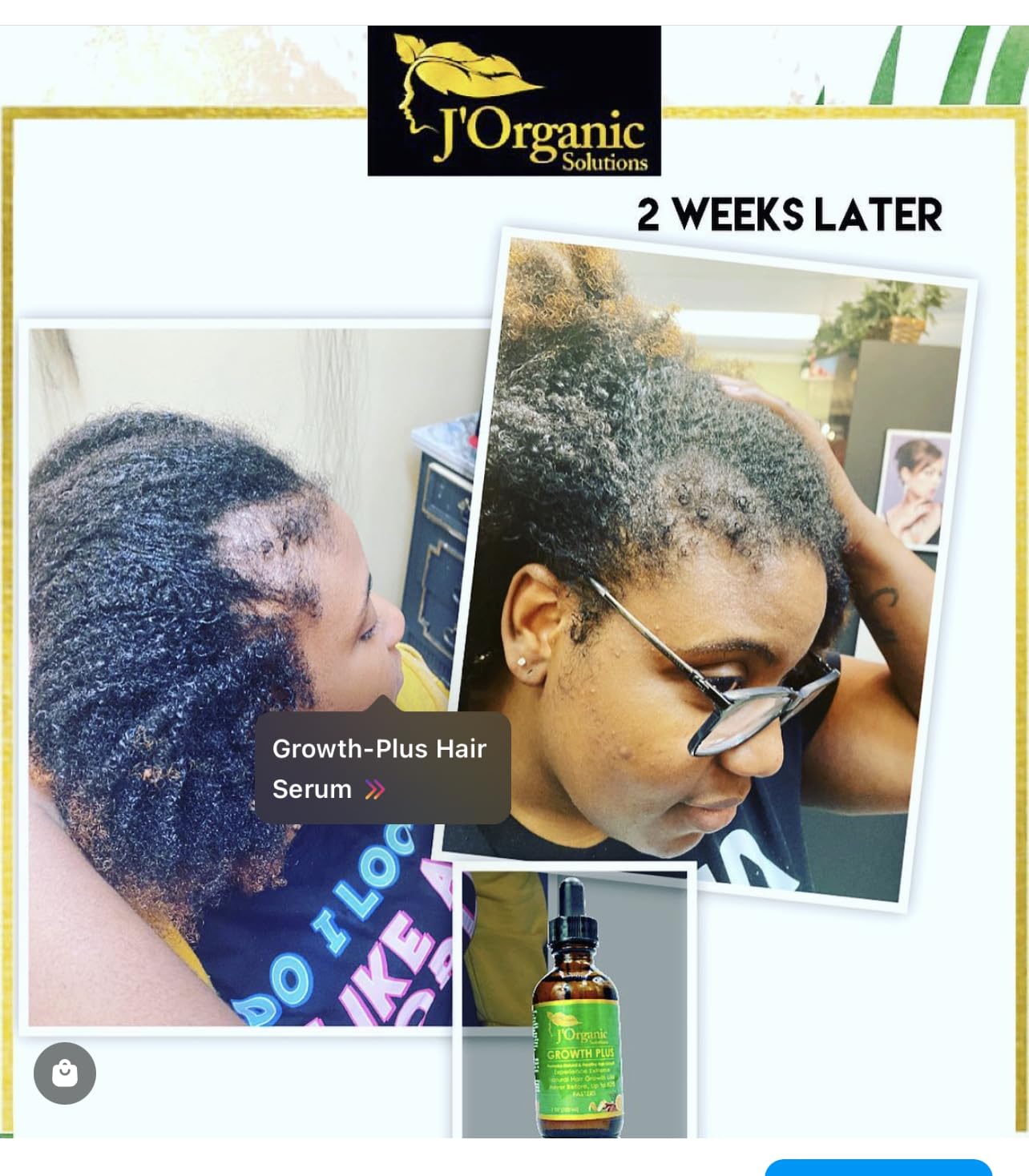 J'Organic Solutions Super Healthy Hair Growth Set (Complete 5 products Set)