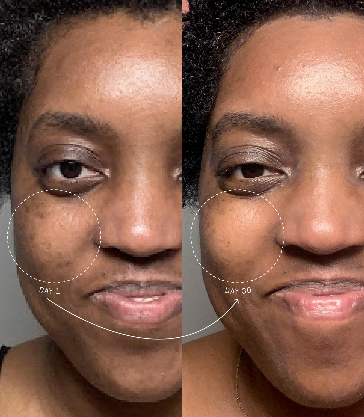 epi.logic Master Plan | Collagen Renew Growth Factor Serum 30 ml / 1 fl oz