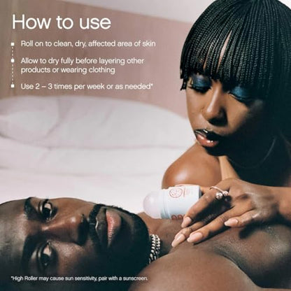 Topicals High Roller Ingrown Hair Serum | Roll-on Tonic to Soothe and Calm Irritated Skin on Face, Armpits and Bikini Areas | Contains Salicylic and Glycolic Acid | Vegan and Cruelty-Free (1.7 Fl Oz)