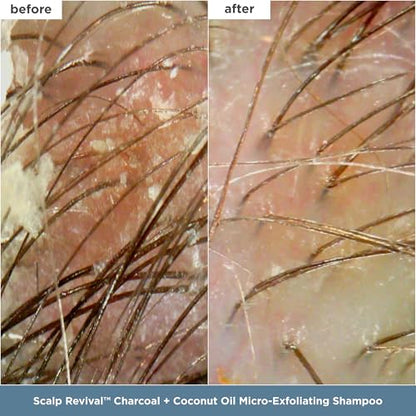 Briogeo Ultimate Hair Heroes Gift Set, Includes 8 fl oz Micro-Exfoliating Shampoo and 8oz Deep Conditioning Mask ($81 Value)