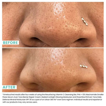 Urban Skin Rx®, PHA + 10% Niacinamide Smaller Pores Serum, Tightens Pores for Clear, Brighter & Smoother Skin, Exfoliates, Decongests, and Controls Excess Oil, 1 Fl Oz.