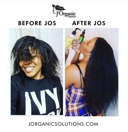 J'Organic Solutions Growth-Plus Scalp Nourishing Oil