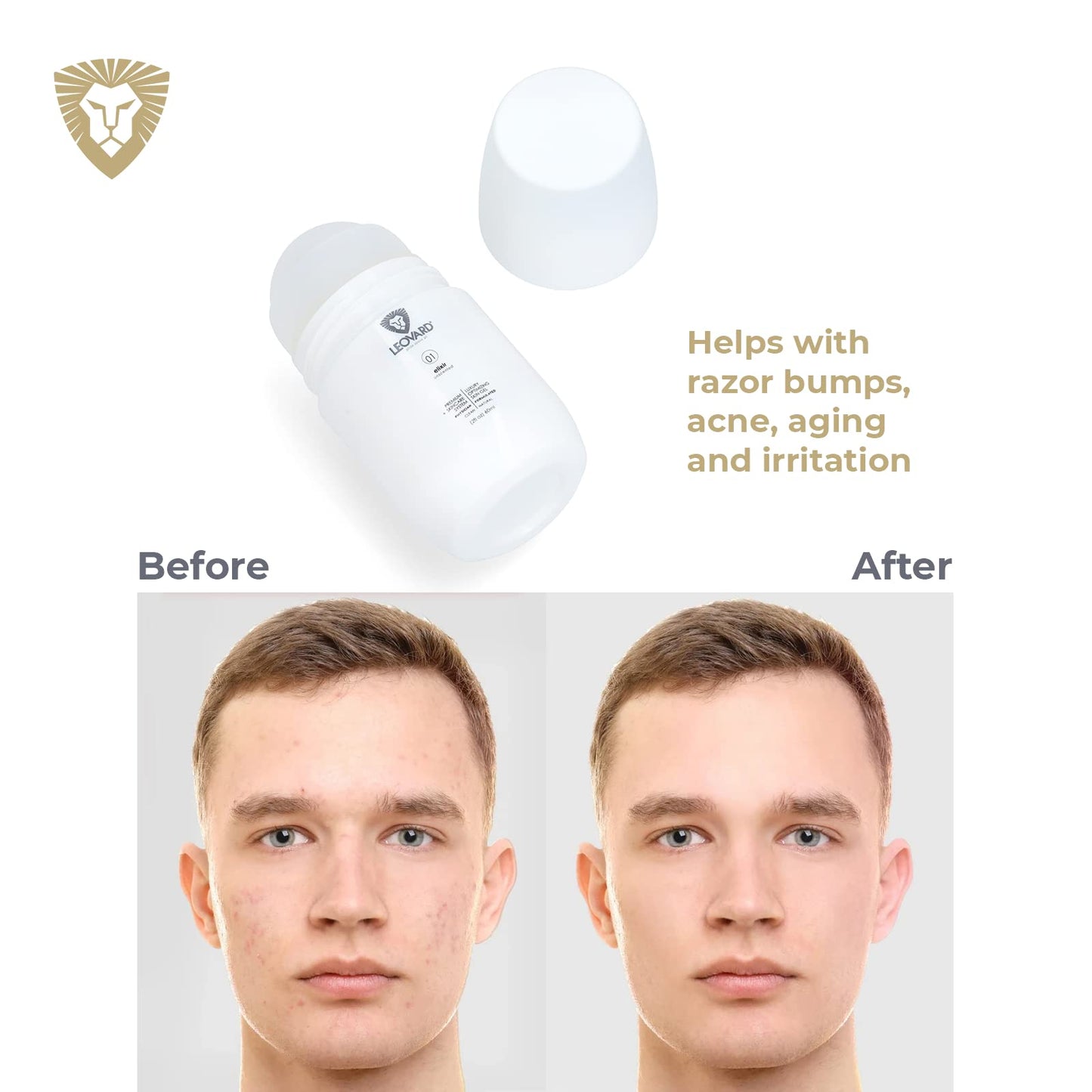 Leovard- Men & Women Razor Bump and Ingrown Hairs Serum - After Your Shave Solution Roll-On for Ingrown Hairs, Razor Bumps, Irritation, Blemishes and Discoloration