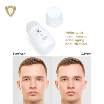 Leovard- Men & Women Razor Bump and Ingrown Hairs Serum - After Your Shave Solution Roll-On for Ingrown Hairs, Razor Bumps, Irritation, Blemishes and Discoloration