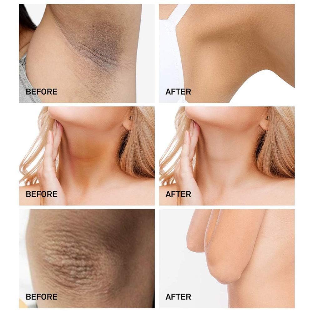 Cosmedica Skincare Vitamin C Facial Moisturizer – 15% Vitamin C Facial Day Cream - 2 ounces – Protects and nourishes skin throughout the day – Vegan, Cruelty Free Skincare