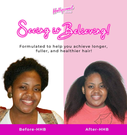 Hollywood Hair Bar Super Grow Scalp Balm - Revitalizing Scalp Balm, Vegan and Cruelty Free, 4 oz