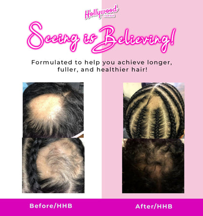 Hollywood Hair Bar | Extra Strength Regrowth Serum and Gummy Vitamin Bundle