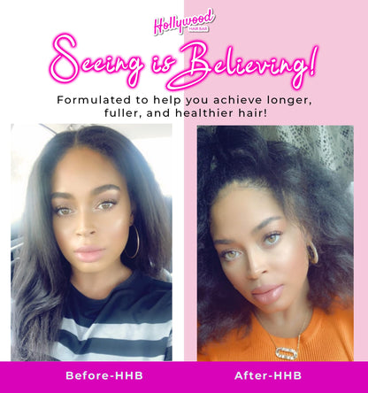 Hollywood Hair Bar | Extra Strength Regrowth Serum and Gummy Vitamin Bundle