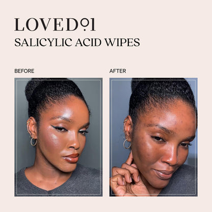 Loved01 Face & Body Salicylic Acid Cleansing Wipes, John Legend Skincare, Oil & Fragrance-Free, No-Rinse, Suitable for Blemish-Prone Skin, 24 wipes