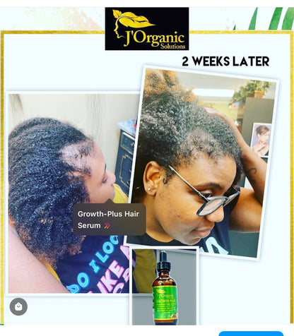 J'Organic Solutions Growth-Plus Scalp Nourishing Oil (4 Fl oz)