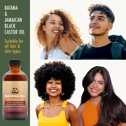 Sunny Isle Batana Oil Infused with Jamaican Black Castor Oil 4oz | Anti-Thinning Double Growth Formula