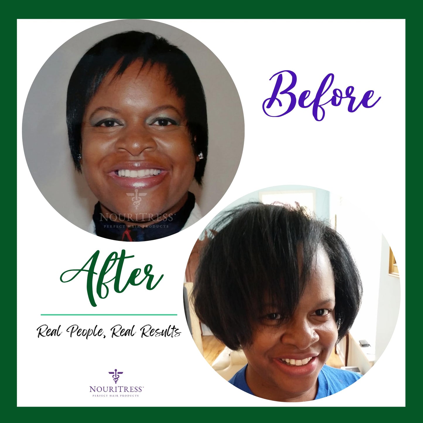 NouriTress Perfect Hair Biotin Gummies - 60 ct. | 5000 mcg | Soft Chew | Supports Healhty Hair, Skin and Nails | Strawberry Flavored | Soft Chew | 1 Month Supply