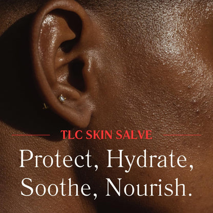 Red Rose Naturals TLC Skin Salve with Calendula | Tea Tree & Lavender