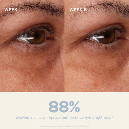 SWEET JULY SKIN Coffee Fix Peptide Eye Cream, Jamaican Blue Mountain Coffee, Peptides, Squalane, Hyaluronic Acid, Depuff and Blur, Clean, Fragrance Free, 0.5 Fl. oz