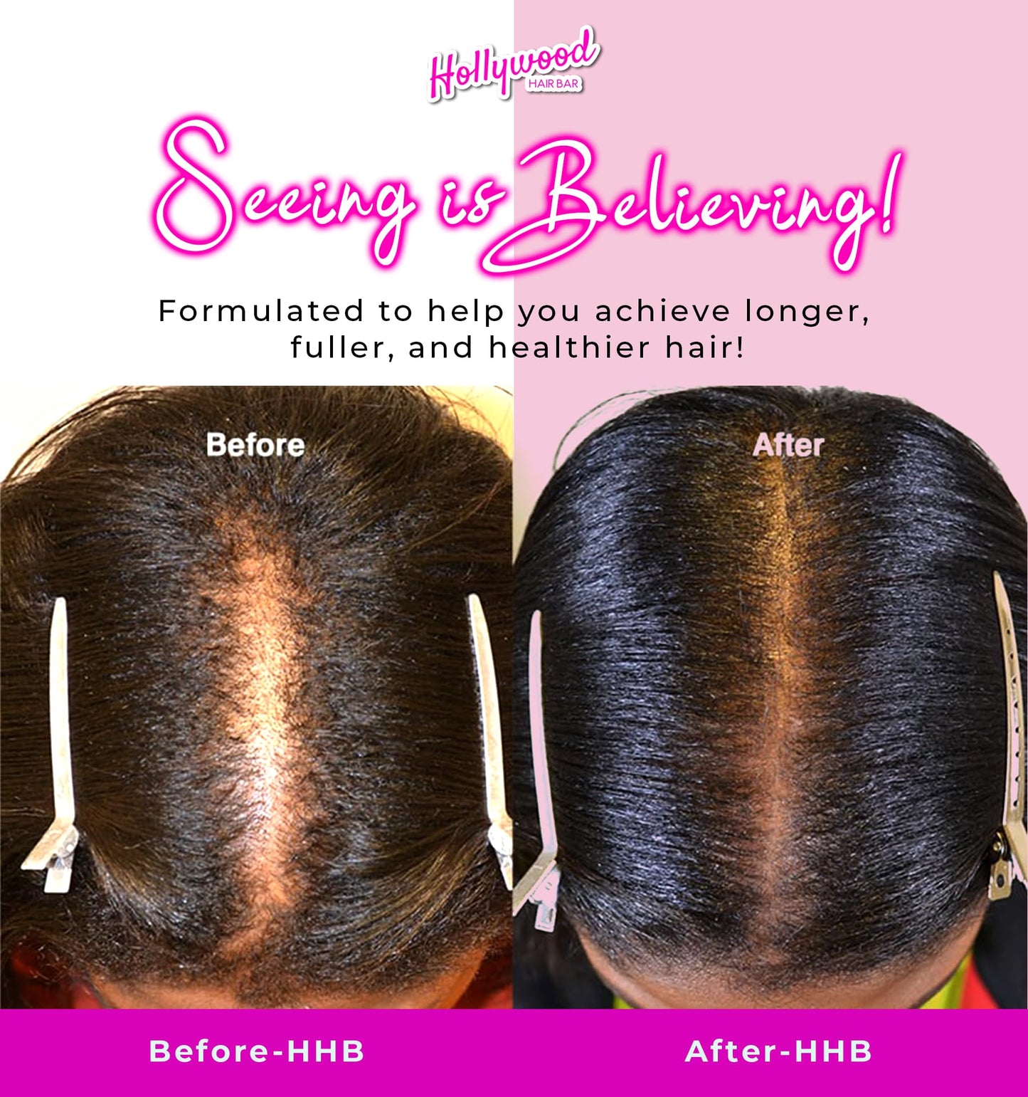 Hollywood Hair Bar | Regular Strength Regrowth Serum and Gummy Vitamin Bundle