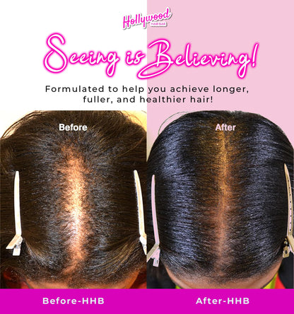 Hollywood Hair Bar | Regular Strength Regrowth Serum and Gummy Vitamin Bundle