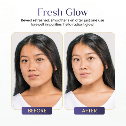 Glycolic Acid Toner Ordinary Glycolic Solution for Face Hydrating and Skin Toner for Women Face with AHA, Aloe Vera, Extract Facial Toner for Brightening, Acne, Exfoliation, and Skin Care 6.4 oz