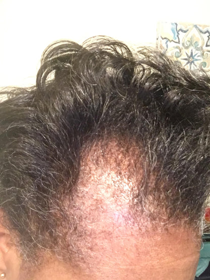 Kreyol Essence - Haitian Black Castor Oil for Skin and Hair, Glass Bottle - Fuller-Looking Hair, Hexane Free, Natural Humectant