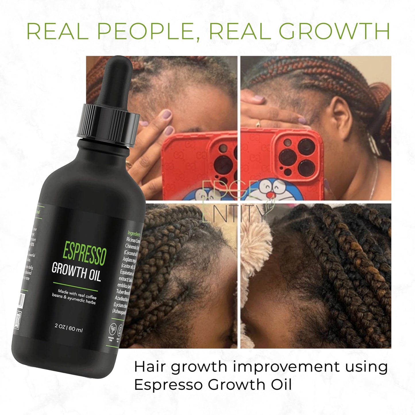 Edge Entity Espresso Hair Growth Oil 2oz – Blend of Castor Oil and Avocado Oil Infused with Coffee Beans, Amla and Ashwagandha for Thicker, Nourished Hair - Ideal for Kinky, Coily and Damaged Hair