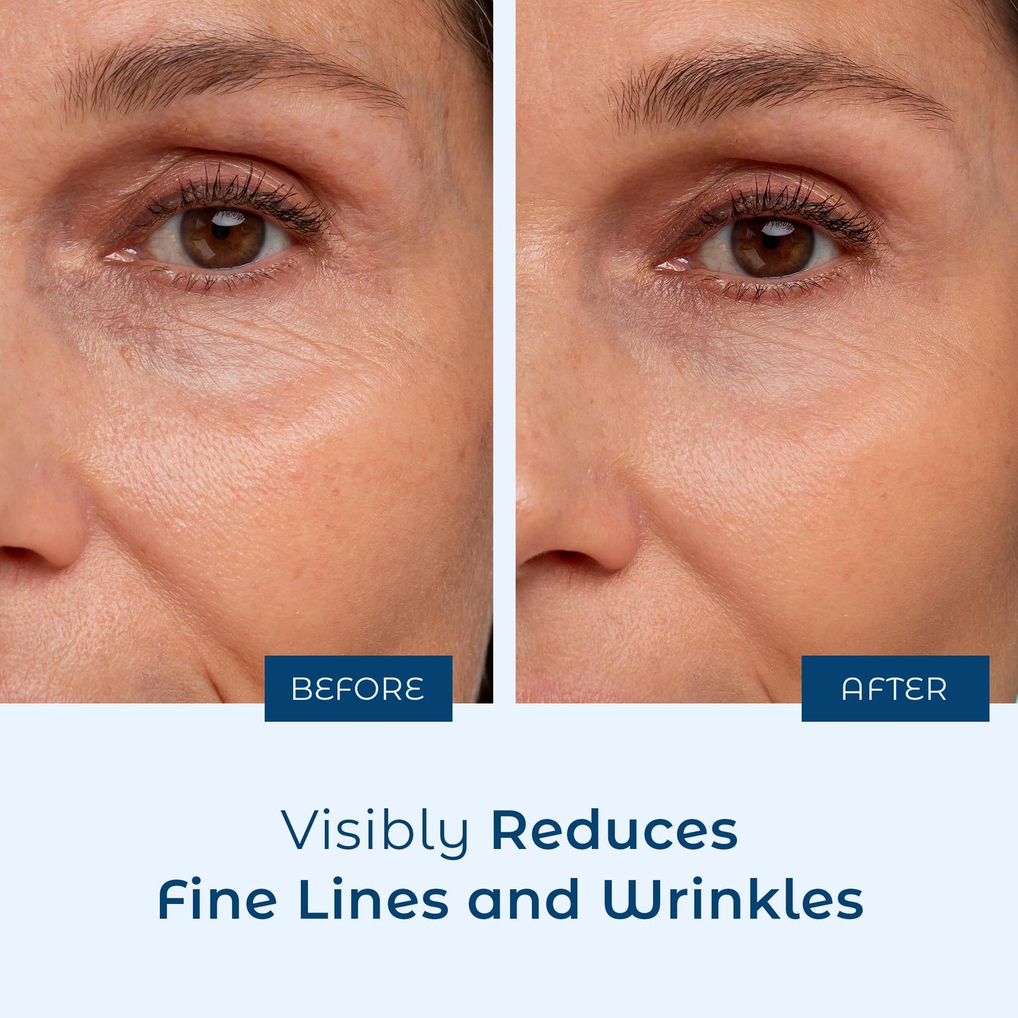 Hyaluronic Acid Serum for Skin 100% Pure-Anti-Aging Serum - Intense Hydration + Moisture, Non-greasy, Paraben-free Hyaluronic Acid for Your Face 8 oz