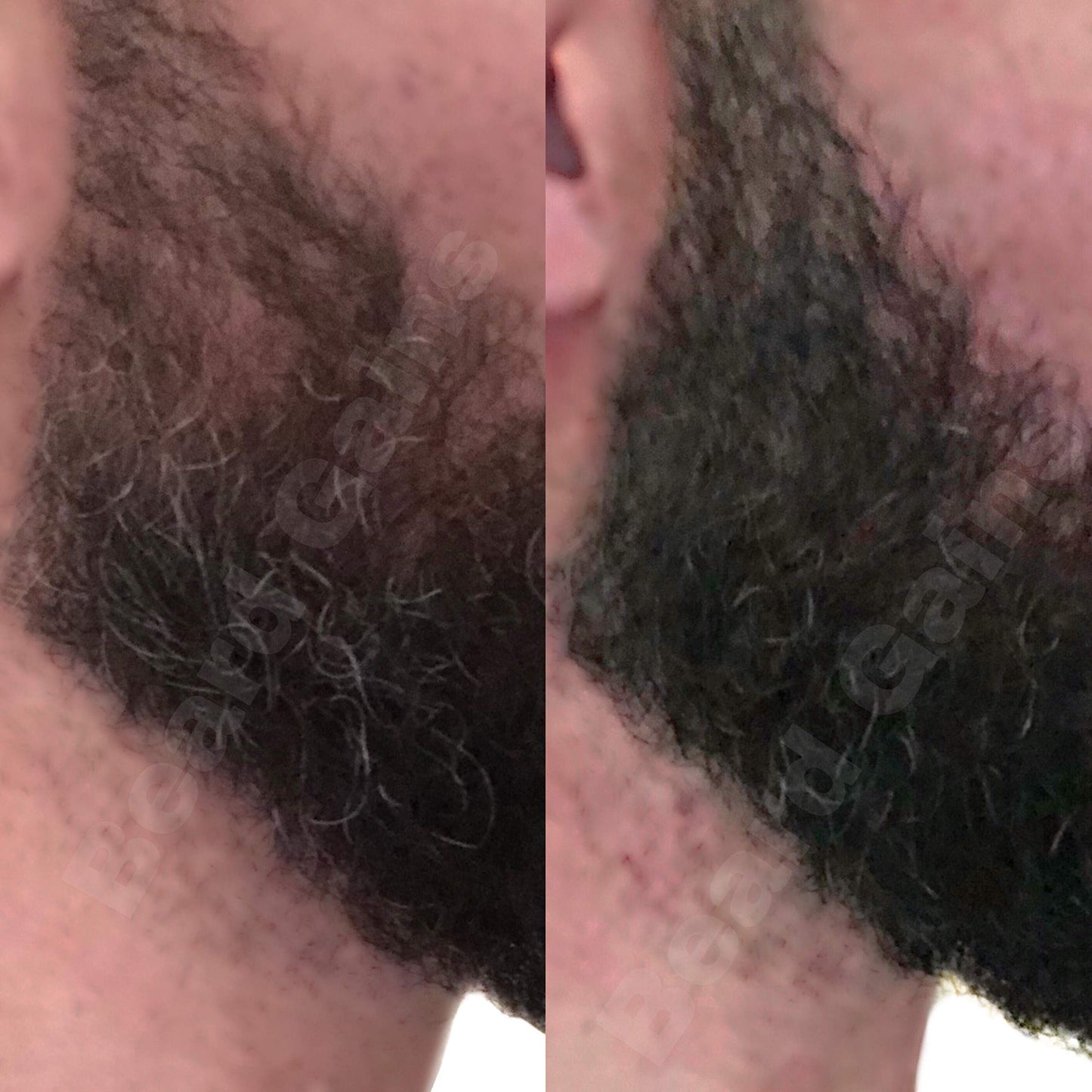 BEARD GAINS Men's Black Temporary Beard Filler, Cover-Up Bald spots, Fill Patches & Add Volume to Facial Hairs Powder | Change Color in Seconds | Easy to Wash (Black Patch & Full Beard Powder)