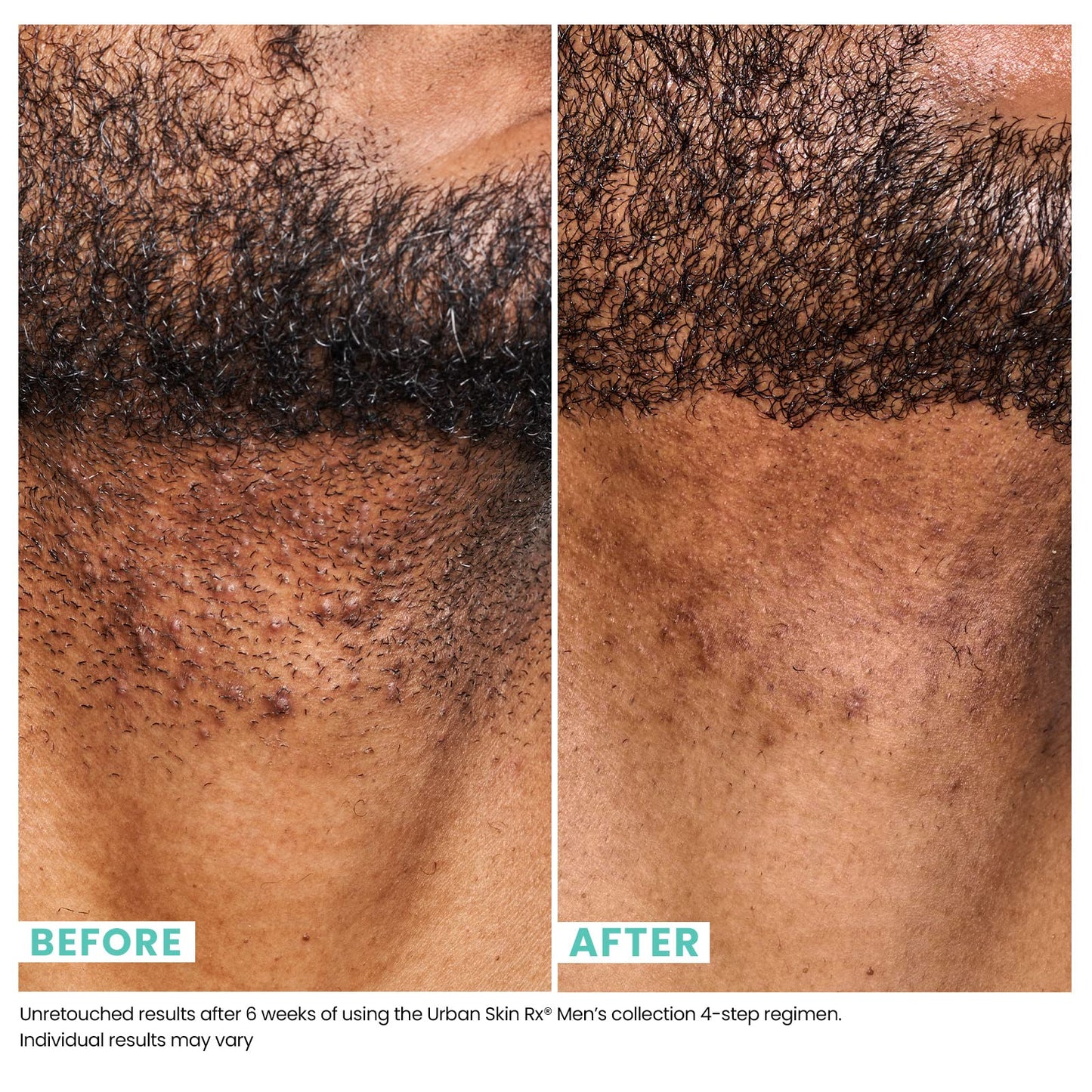 Urban Skin Rx Mens Daily Even Tone Moisturizer, Soothing, Lightweight Moisturizer for Men, Hydrating for Skin, Formulated with Hyaluronic Acid, Aloe, Niacinamide and Provitamin B5, 1.7 Fl Oz