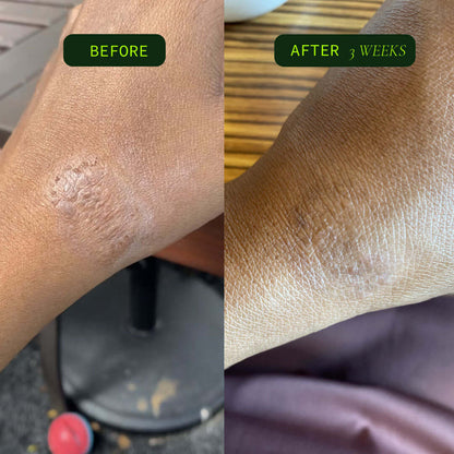 Omega Body Oil: Coriander Seed